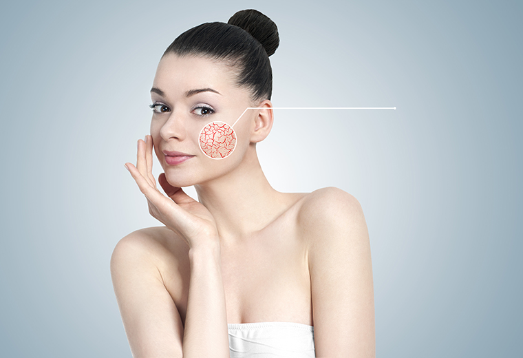 Cera naczynkowa - jak dbać o nia zimą