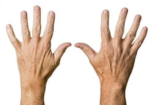 Problem siniejących dłoni