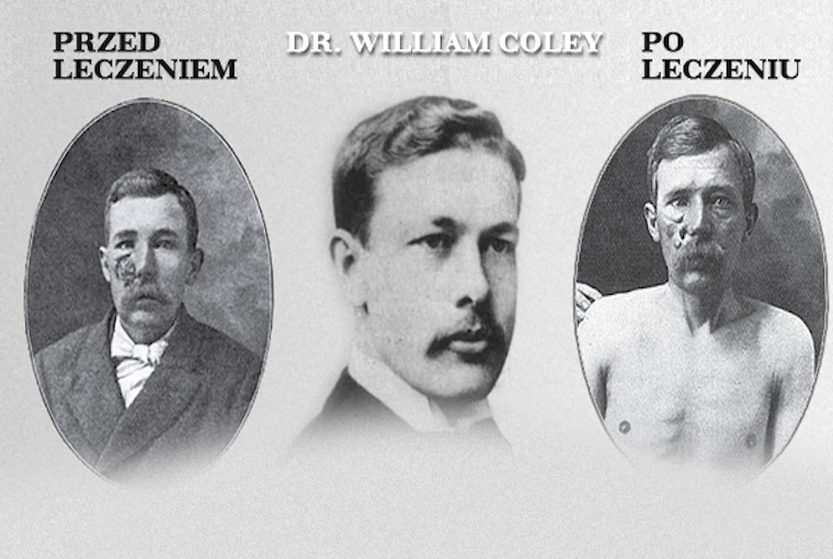 Fot. do artykułu: 'Zapomniane remedium na raka'