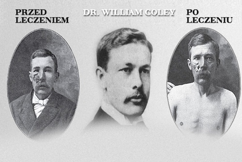 Zapomniane remedium na raka