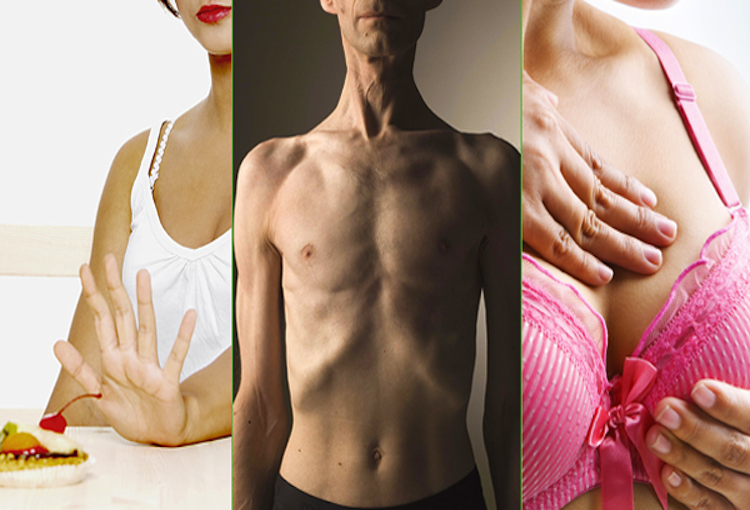 Czy to rak? Jakie symptomy powinny Cię zaniepokoić?