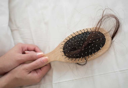 Wypadanie włosów po przebytym …