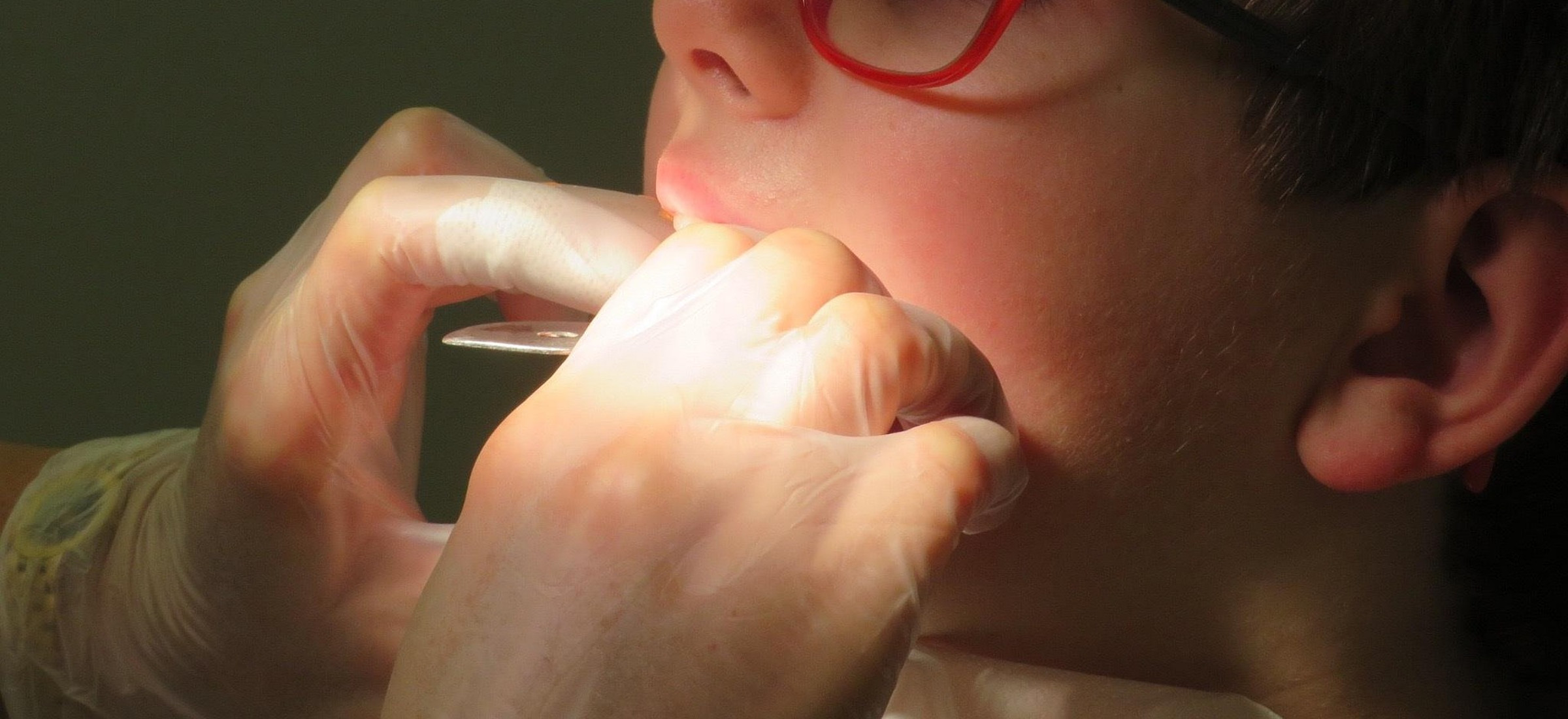 Leczenie u dentysty można odpisać od podatku? Jest decyzja skarbówki