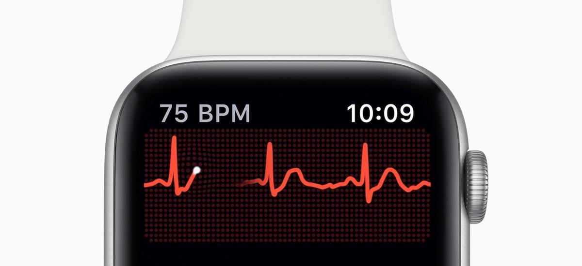 ECG on Apple Watch versus exam in a clinic. We compared the results