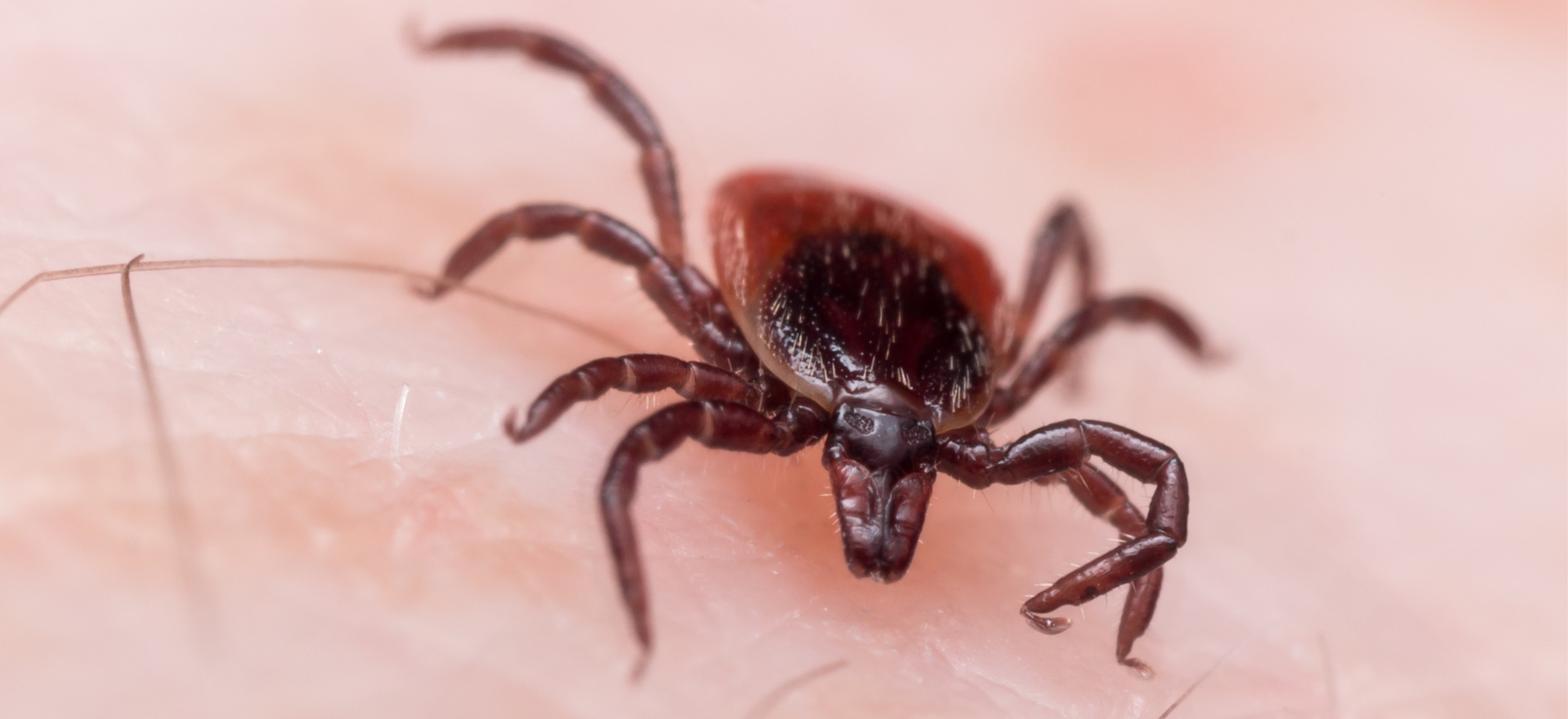 Zespół alfa-gal. Kleszcze wywołują alergię na mięso