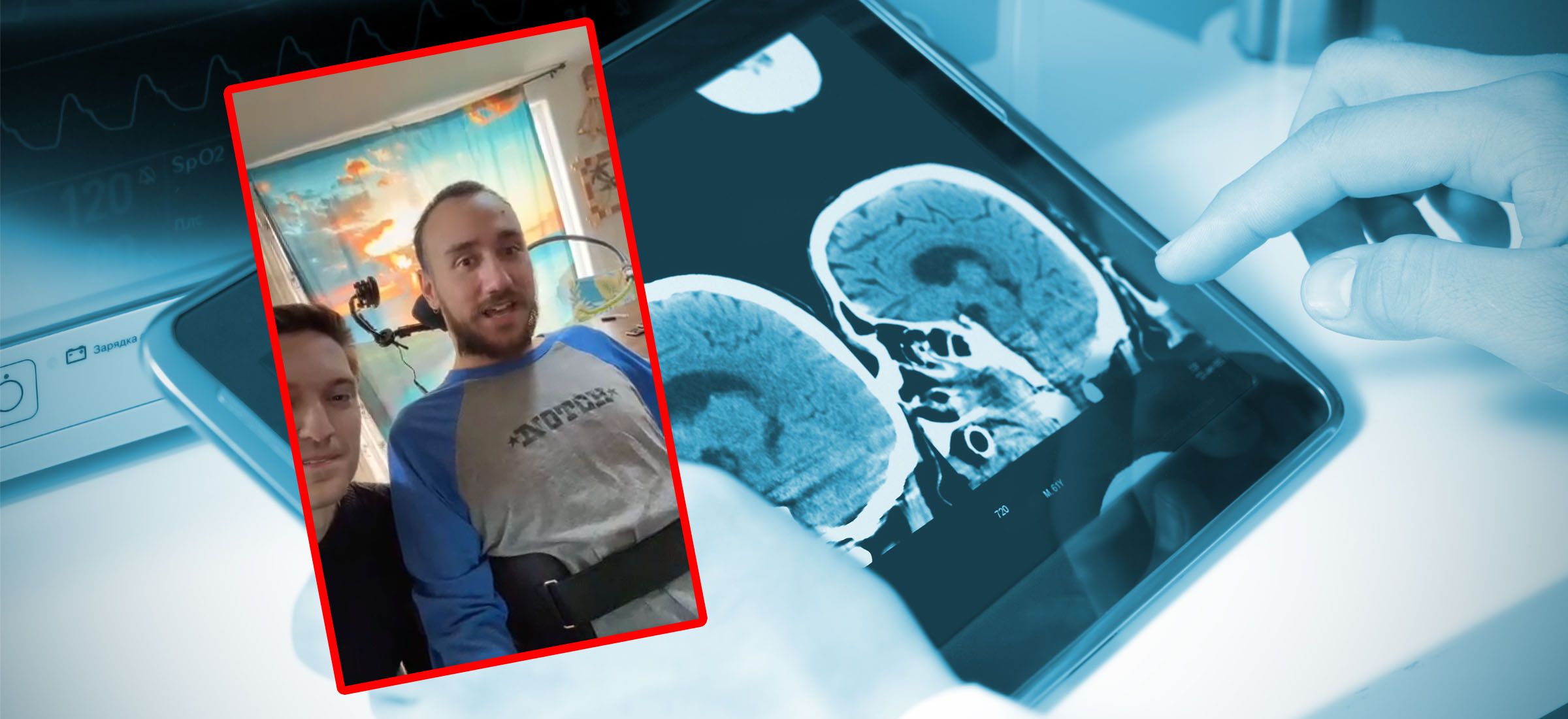 Ten człowiek steruje komputerem za pomocą myśli. Neuralink pokazał nagranie
