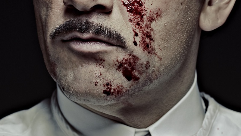 the knick 2