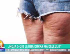 pytanie na śniadanie cellulit tvp
