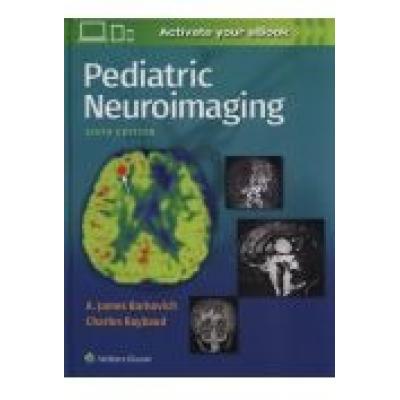 Pediatric neuroimaging 6e