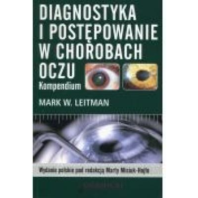 Diagnostyka i postępowanie w chorobach oczu. kompendium