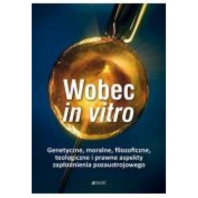 Wobec in vitro