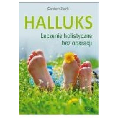 Halluks. leczenie holistyczne bez operacji