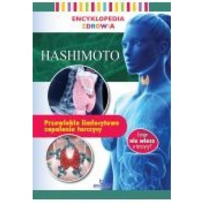 Encyklopedia zdrowia. hashimoto