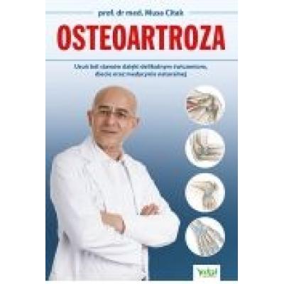 Osteoartroza. usuń ból stawów dzięki delikatnym..