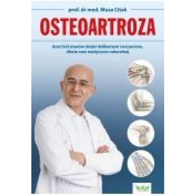 Osteoartroza. usuń ból stawów dzięki delikatnym ćwiczeniom, diecie oraz medycynie naturalnej