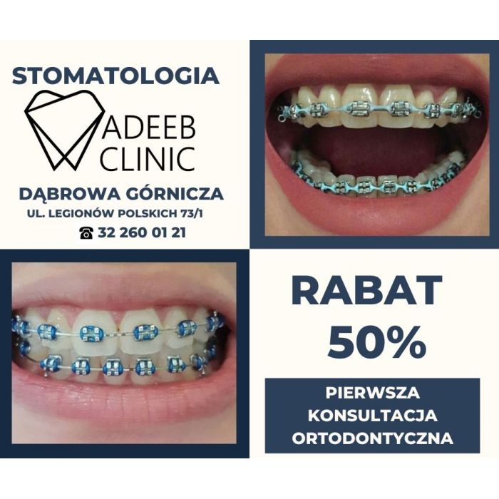 ORTODONTA -50% TANIEJ PIERWSZA WIZYTA W ADEEB CLINIC