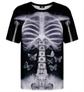 X-ray t-shirt